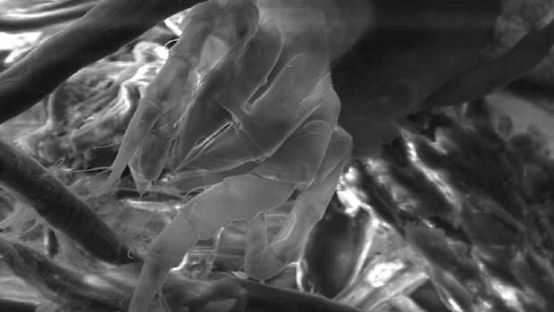 Dust mite found in homes