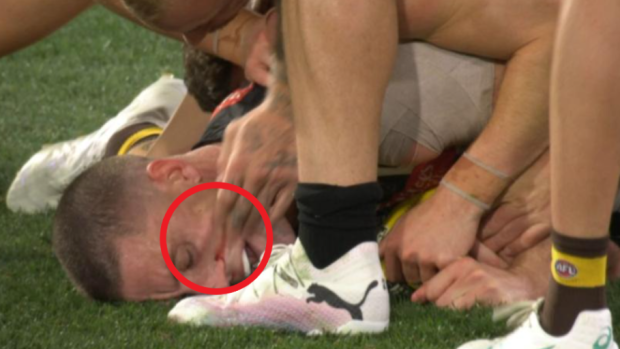 De Goey was caught wiping blood from Cameron's face.