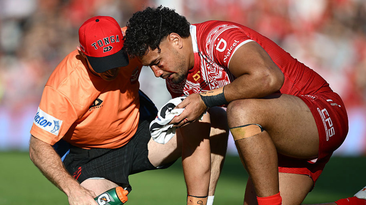 Keary's alarming concussion test claim after 'horrible' saga