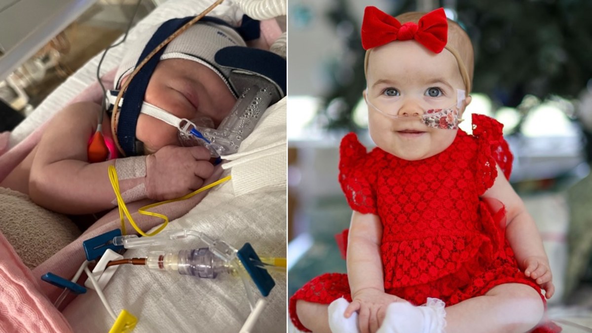 'Our Christmas miracle': Baby born with organs outside body defies the ...
