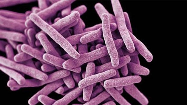 A microscopic view of Candia auris.