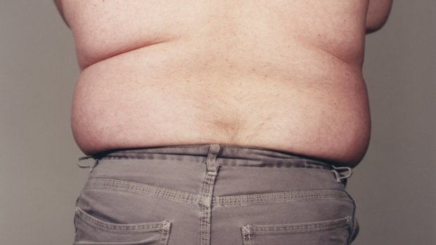 Obesity is a growing problem around the world.