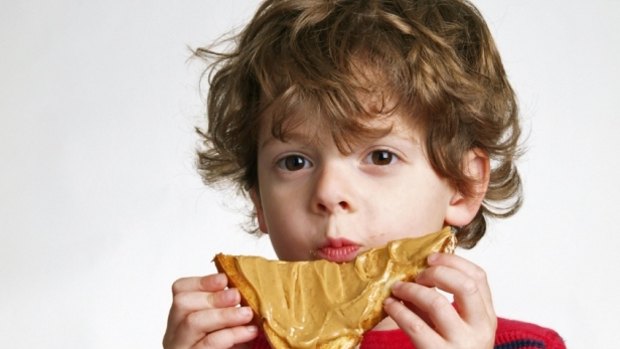 More than 80 per cent of children in the Melbourne trial were cured of their peanut allergy.