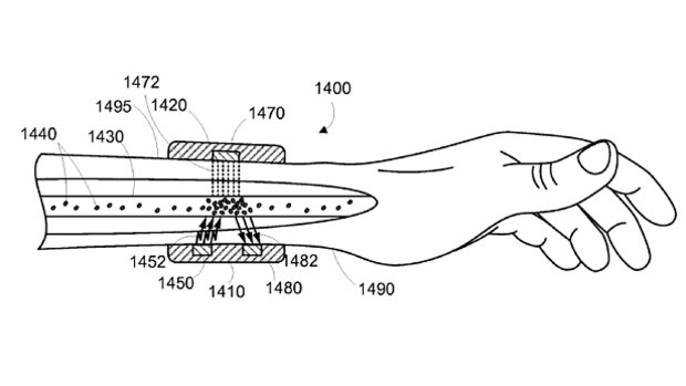 A wearable to fight disease: An image from Google's patent application.