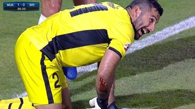 Brisbane Roar goalkeeper Jamie Young after injuring his arm on a rusty hook in the AFC match against Muangthong United. The $10,000 fine for Thai club was equal to the Roar's meal indiscretion.