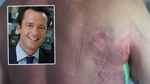 Hamish McLachlan is still in hospital recovering.