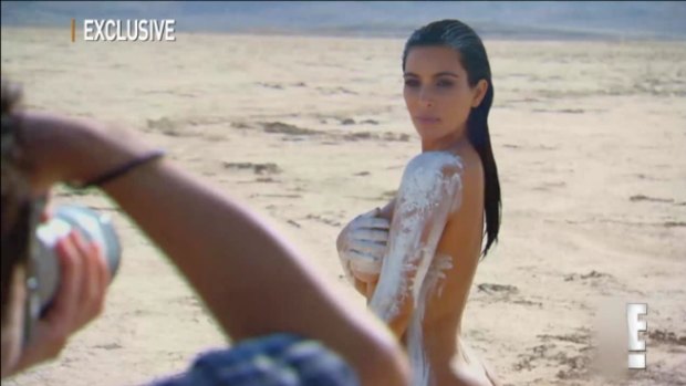 Kim Kardashian has spoken candidly about her skin condition during a nude photoshoot.