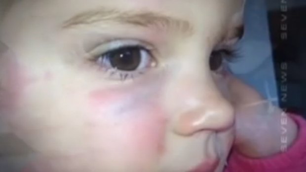 "Somebody has failed": Eva Ness, 2, was attacked by an older boy at a Sydney creche.