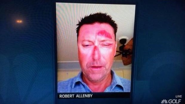 A photo showing Robert Allenby's injuries was aired on television.