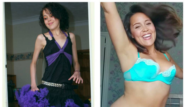 Megan Jayne's before-and-after pictures have been viewed by thousands.