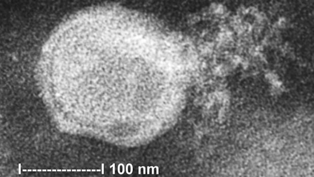 The human metapneumovirus, as seen from an electron microscope.