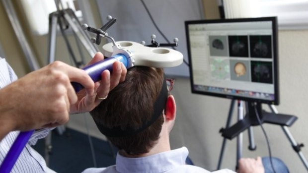 Transcranial Magnetic Stimulation. 