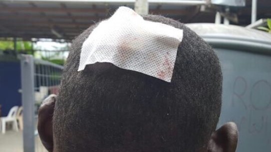 A Sudanese refugee received stitches after being hit by rock.