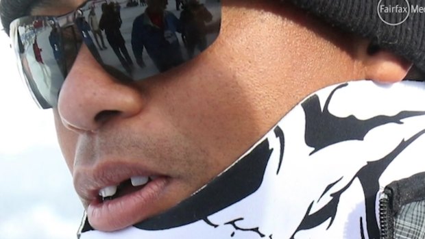 Tiger Woods came to watch girlfriend Lindsey Vonn win her 63rd World Cup skiing title but it was his missing front tooth that got all the attention.