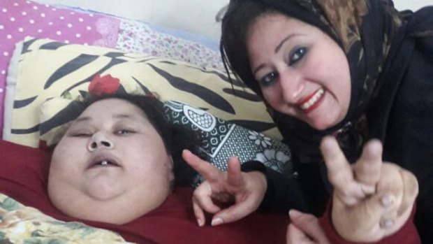 Eman and her sister, Shaimaa Selim, before Eman's operation.