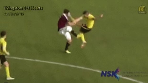 Sam Nicholson takes a blow to the face from the boot of the Livingston captain.