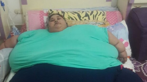 Eman Ahmed has been confined to a bed for 20 years. 