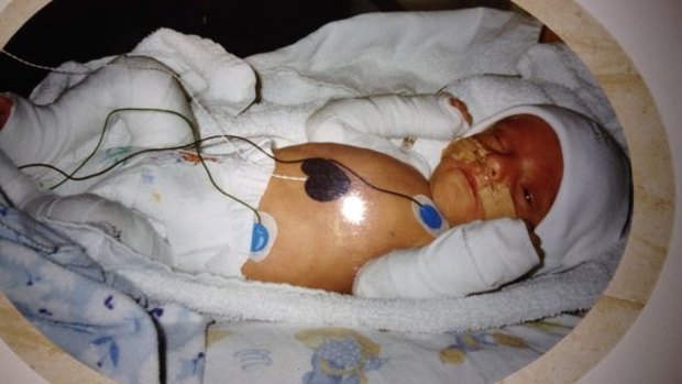 Jake Harrington at nine days old, after having his first heart operation. 