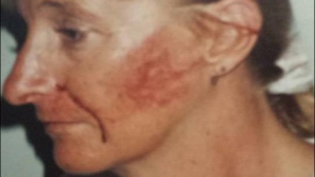 Wendy Lloyd was rushed to hospital after the attack in 2003.