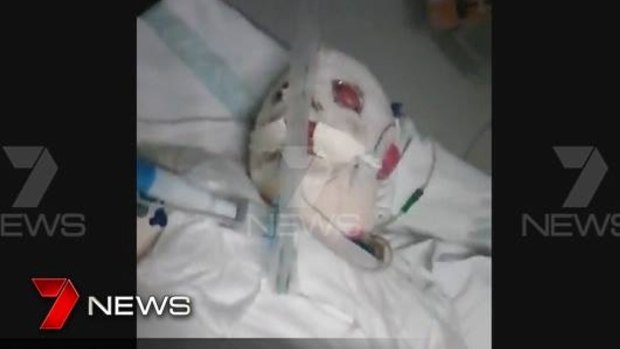 A screenshot of the injured boy, as shown by Channel Seven.