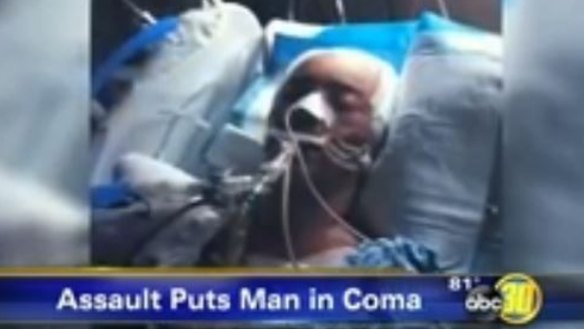 Former champion rower Robert Scott fights for life after being attacked ...
