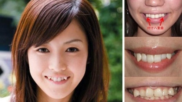 Cute? The snaggletooth trend has been growing in Japan.