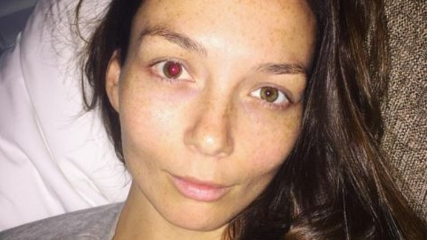 First world problem: Ricki-Lee Coulter was recently the victim of a wayward champagne cork that hit her in the right eye.