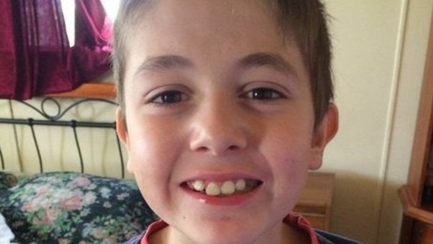 Nine-year-old Caleb Gundy is undergoing treatment for serious burns.