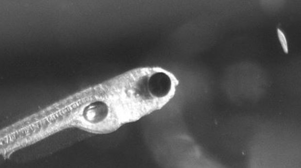 Larval zebrafish getting ready to eat a paramecium.