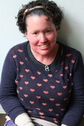 Writer and appearance activist Carly Findlay.