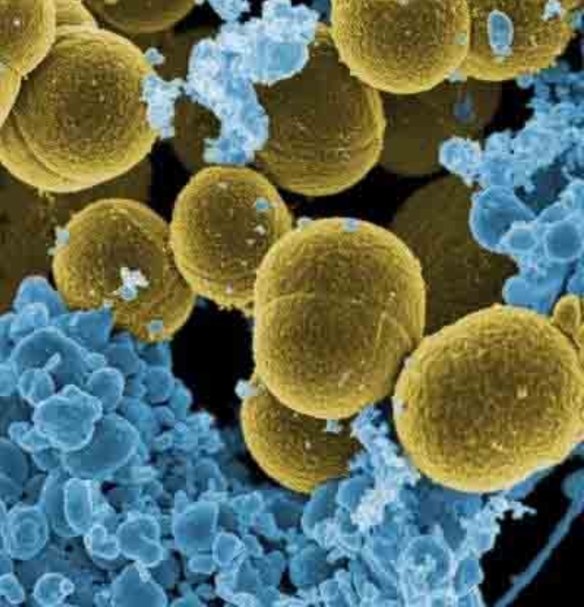 Golden staph infections rising in community, GPs blame antibiotic overuse
