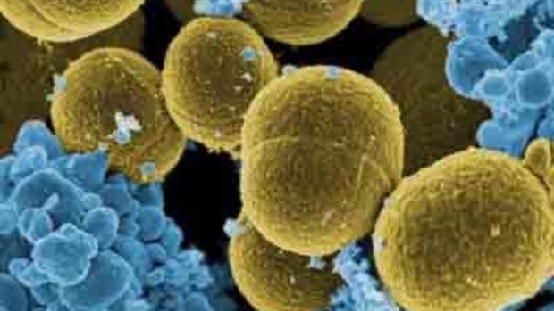 MRSA is resistant to conventional antibiotics because of their overuse.