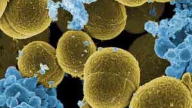 A drug-resistant strain of golden staph (ca-MRSA) which can cause serious illness in healthy people.