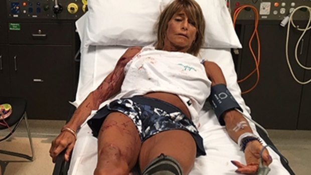 Debbie Urquhart after the kangaroo attack on Saturday.
