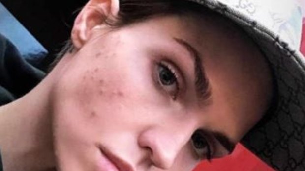 Ruby Rose hit back about acne comments on her Instagram. 