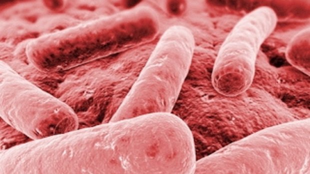 An image of Klebsiella pneumonia, a form of bacterial pneumonia.