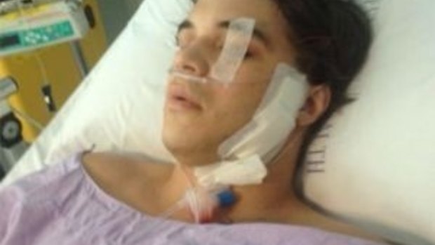 This image of Luke Perrett after the attack was tweeted by his father, politician Graham Perrett.