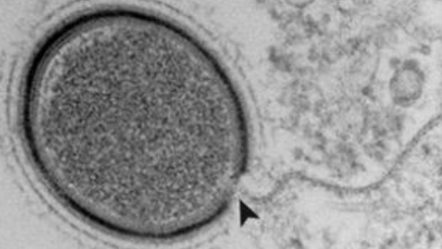 Mollivirus particle at a late assembly stage. 