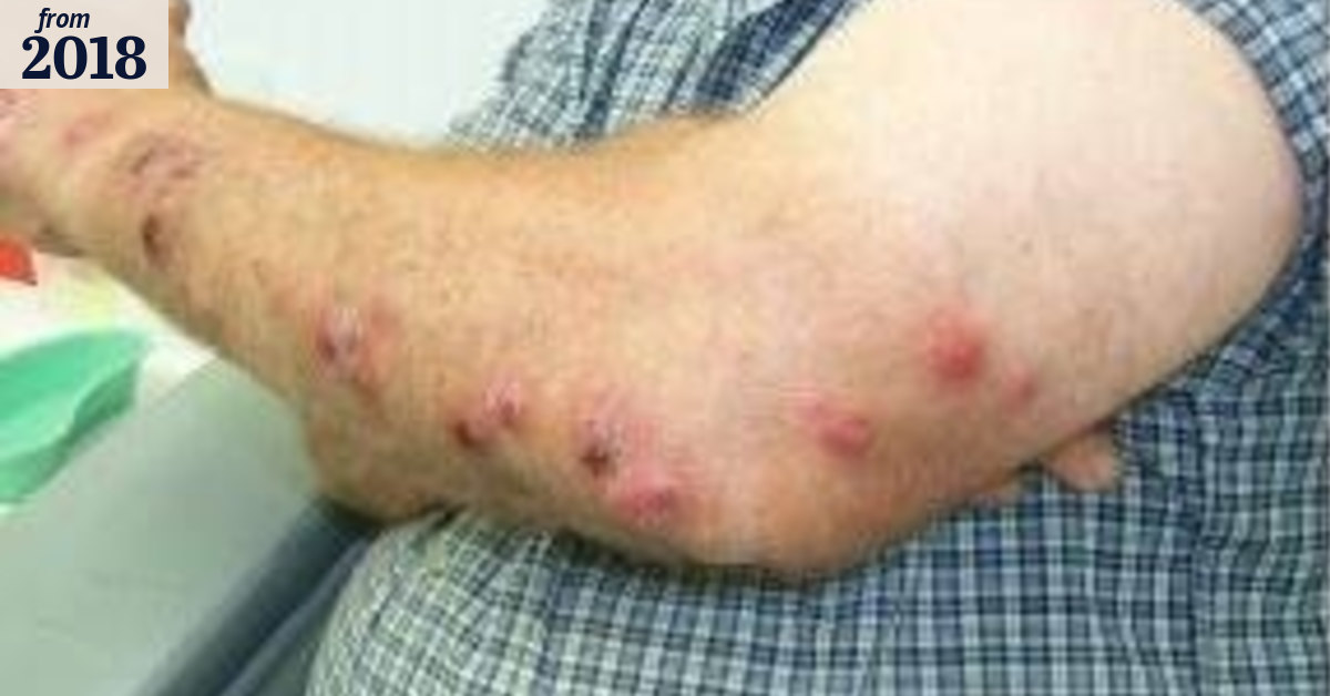Mouldy hay disease not so fun-gus for South West green thumbs