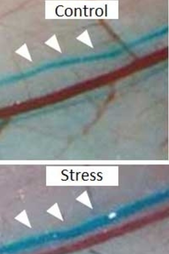 Image of lymph vessels in a healthy mouse (top) and a stressed mouse (below). 