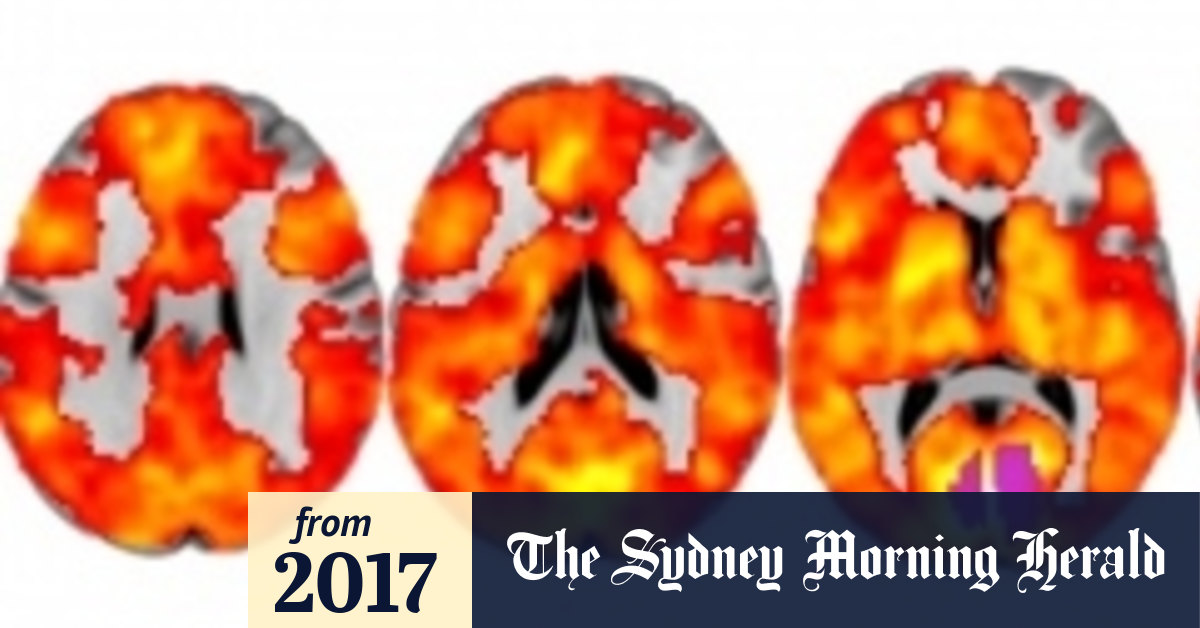 LSD and a terrifying fling with 'ego death' nearly ruined a Sydney teen's life LSD and a terrifying fling with 'ego death' nearly ruined a Sydney teen's life