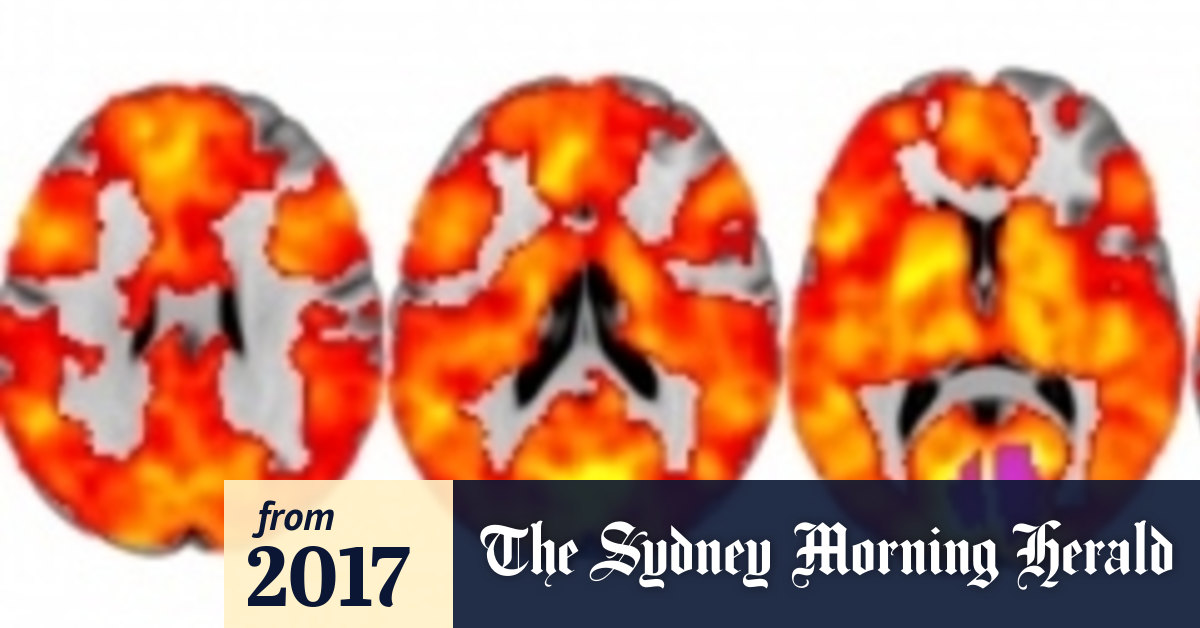 Lsd And A Terrifying Fling With Ego Death Nearly Ruined A Sydney