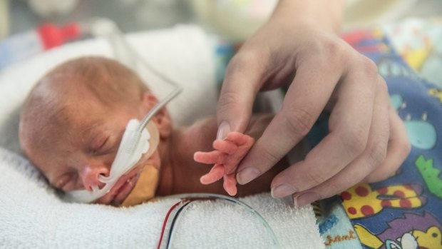 Delayed clamping of umbilical cord could save thousands of