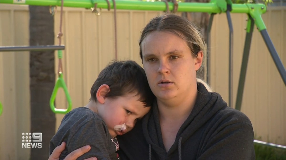 Dog attack Adelaide: Child bitten on face in Paralowie police calling ...