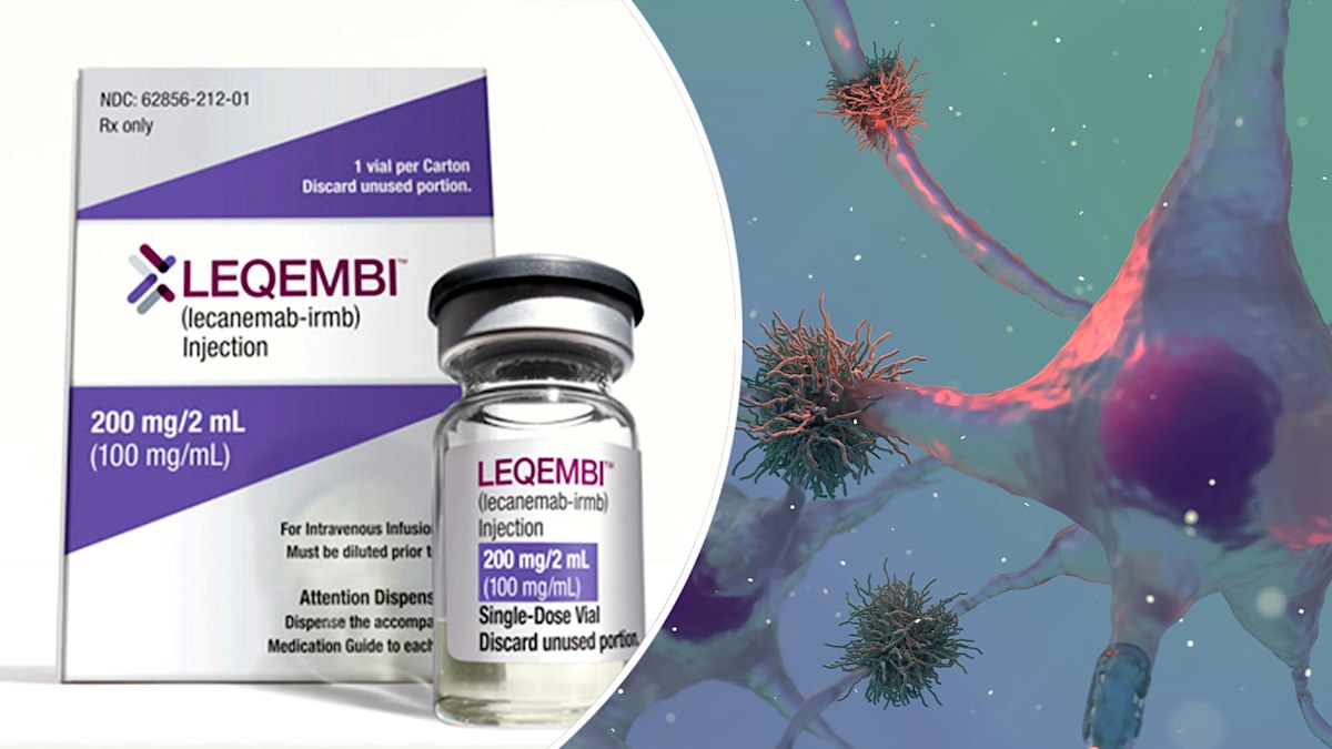 Lecanemab drug: Dementia Australia 'disappointed' after Alzheimer's ...