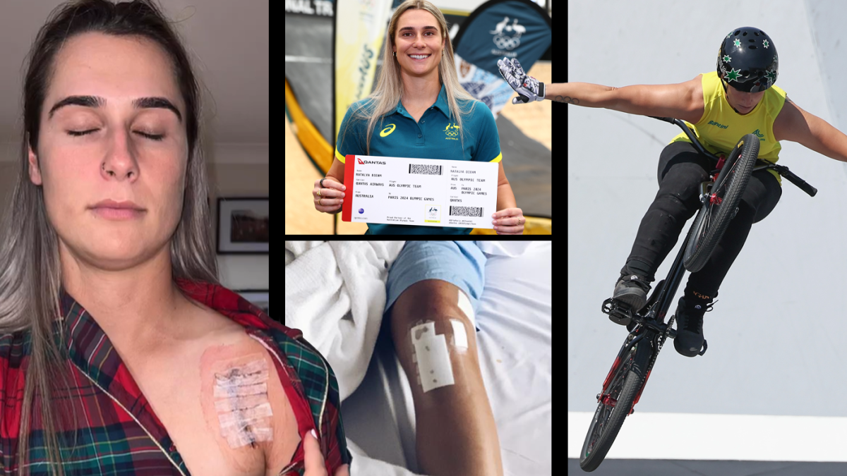 Teshikli külotlarning fotosurati