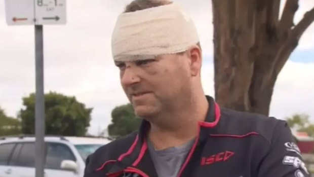 Not a good day: Malcolm Woodford was allegedly hit with a shovel at a remote campsite at Glenaire off the Great Ocean Road.