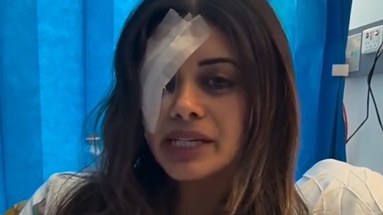 Hannah Thomas is in Bankstown Hospital with a serious eye injury requiring surgery after she was arrested with four others at a pro-Palestine protest in Sydney’s south-west.