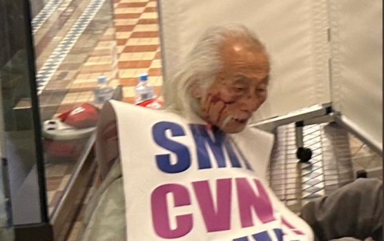 Danny Lim’s bloody face makes us recoil yet again at police use of force