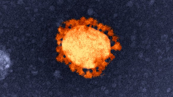  An electron-microscope image of the COVID-19 virus, isolated from the first Australian coronavirus case. Note the bubble in the centre surrounded by spikes.